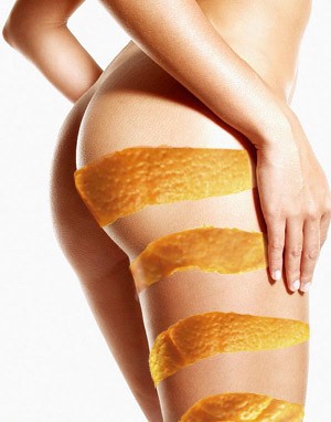 MASAJES REDUCTIVOS Anuncios gratis para novios en Santiago |  MASAJES REDUCTIVOS, YESOTERAPIA LIPOLITICA, ACUPUNTURA ESTETICA  6344352, REDUCE M&Aacute;S DE 14 CM POR TRATAMIENTO 12 SESIONES X 99.000.-
