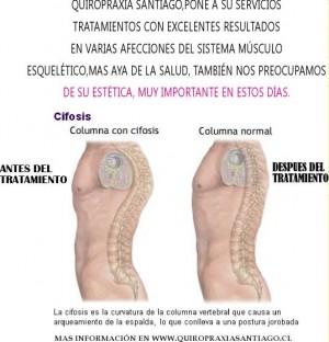 carlos Anuncios gratis para novios en Santiago |  quiropr&aacute;ctico en santiago, masajes
