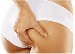 ILSE Anuncios gratis para novios en Valpara&iacute;so |  TRATAMIENTOS CORPORALES MASAJES REDUCTIVOS TERMOTERAPIA CRIOTERA, 12 SESIONNES  A DOMICILIO VALPARAISO